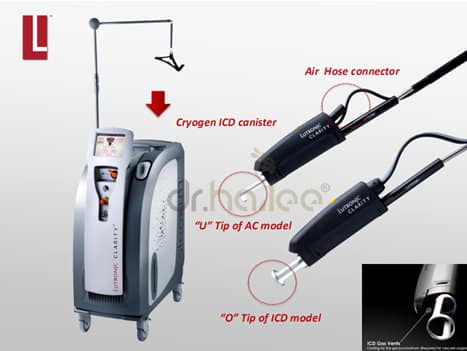 Hình ảnh minh họa trị giãn mao mạch bằng công nghệ laser xung dài Clarity