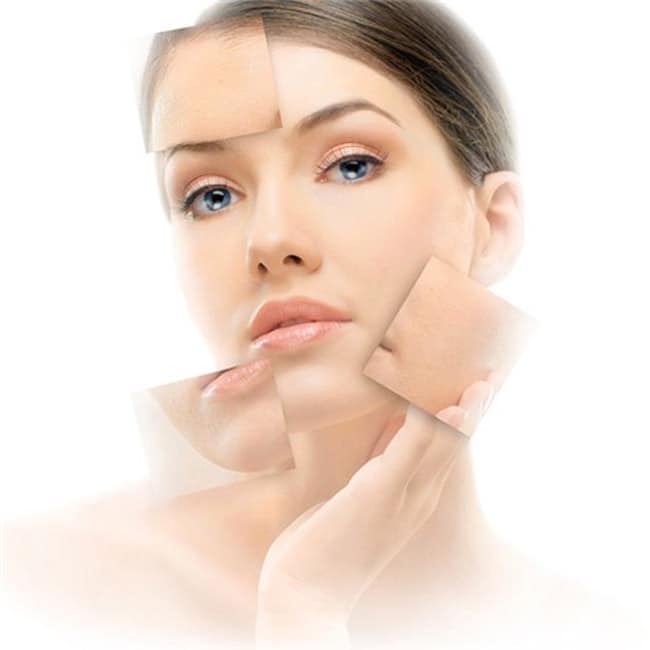 Sau khi điều trị bạn không cần phải nghỉ dưỡng
