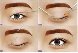 phương pháp nhấn mí đẹp tự nhiên nhất 3a