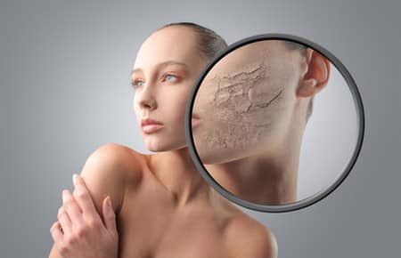 Điều trị da khô nứt nẻ vào mùa đông