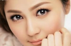 Nám da là nỗi lo lắng của rất nhiều chị em phụ nữ