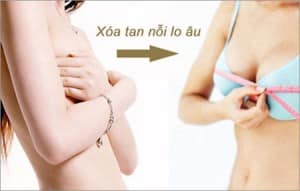 Làm hồng nhũ hoa - xóa tan nỗi lo âu cho chị em