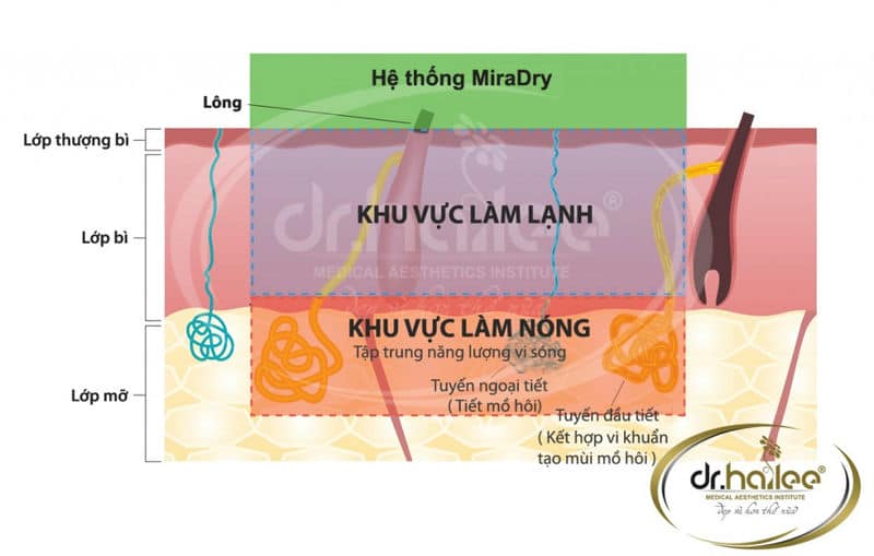Cách trị hôi nách hiệu quả lâu dài