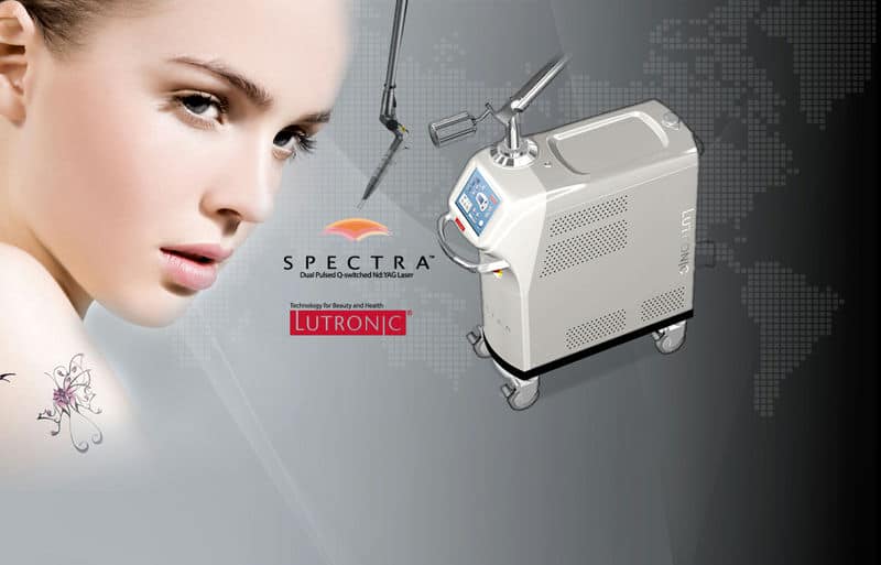 Máy Laser Spectra xóa bớt hiệu quả