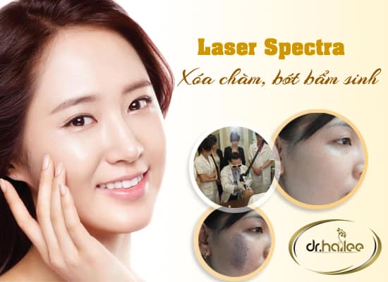 Xóa bớt bằng công nghệ laser Spectra