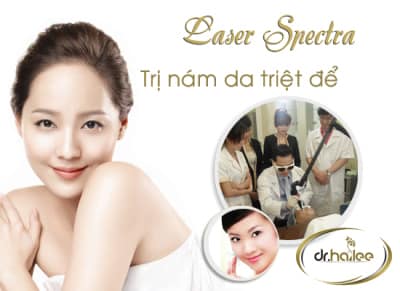 trị nám tận gốc với công nghệ Laser Spectra