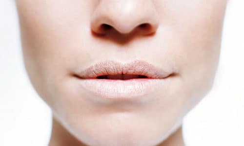 Biết nguyên nhân sẽ giúp bạn trị môi khô tốt hơn